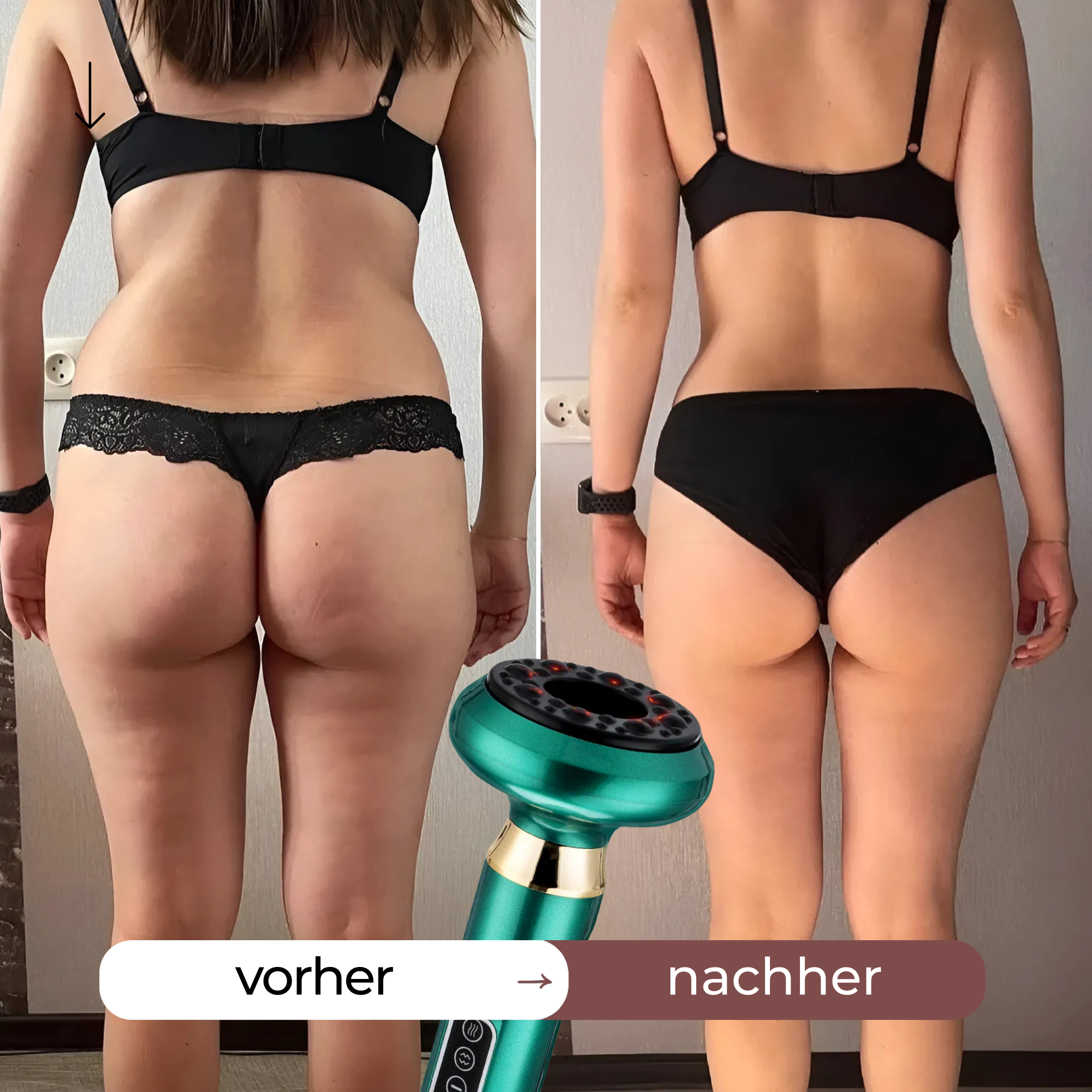 Anti-Cellulite Massager by VacuRoller™